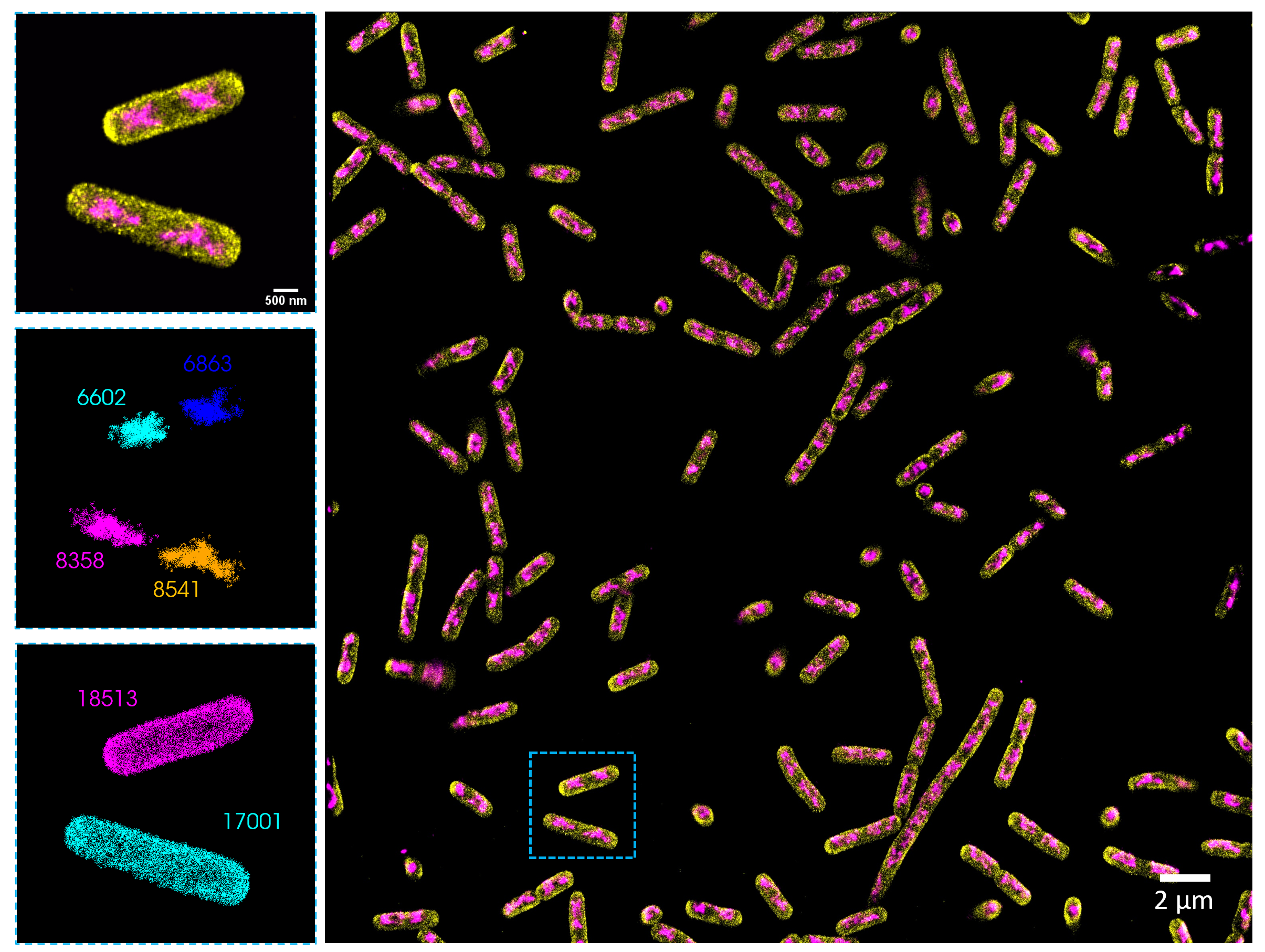 E. coli  Membrane and Chromosome
